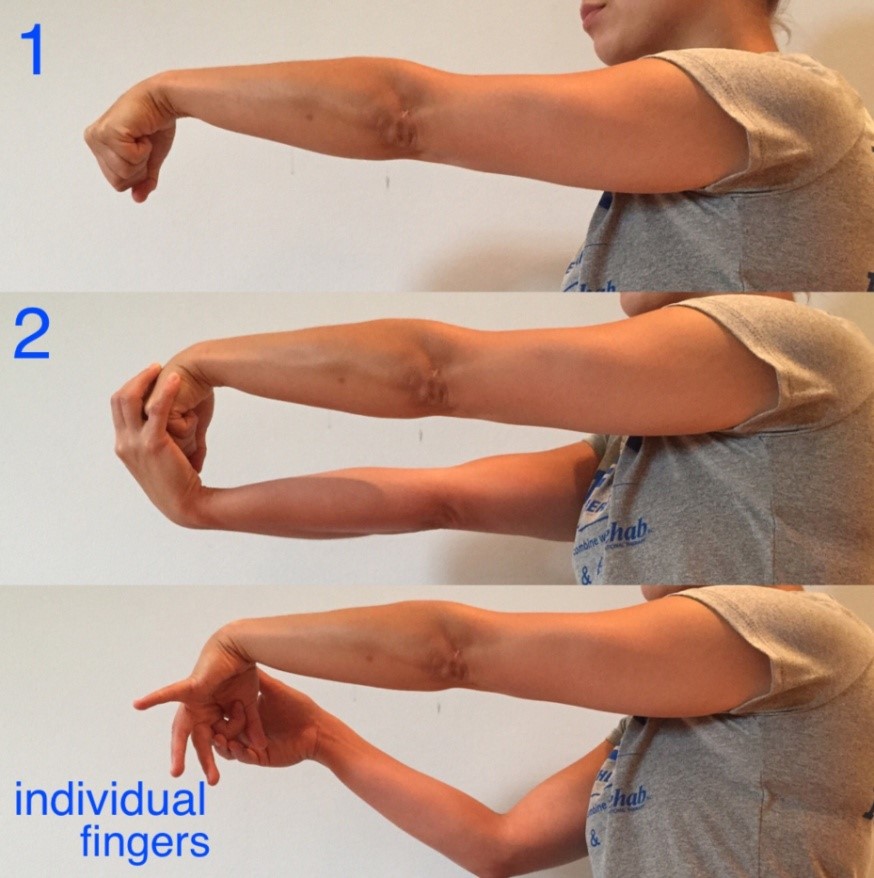 Golfer’s Elbow Exercises